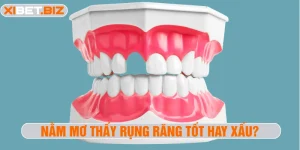Nằm mơ thấy rụng răng tốt hay xấu